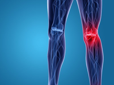 Protesi del ginocchio